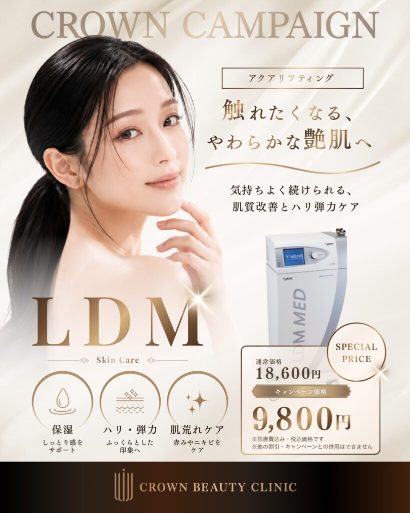 LDM
